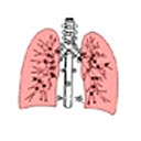Doenças do Mediastino - Os dois pulmões, e entre eles o mediastino.